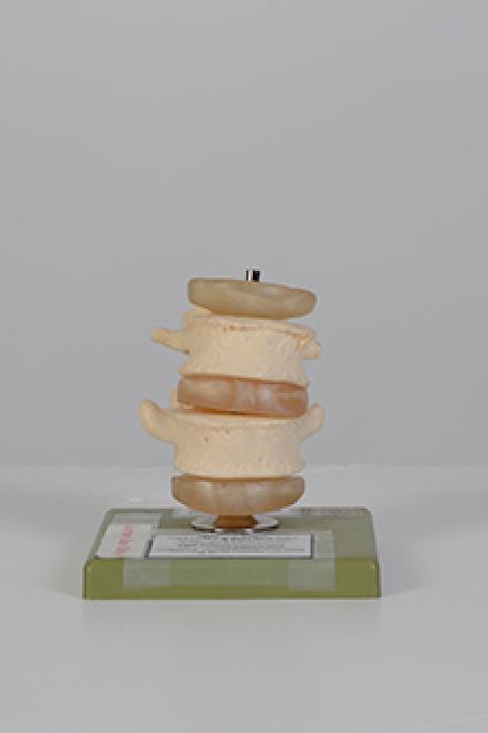 Lumbar model #1
