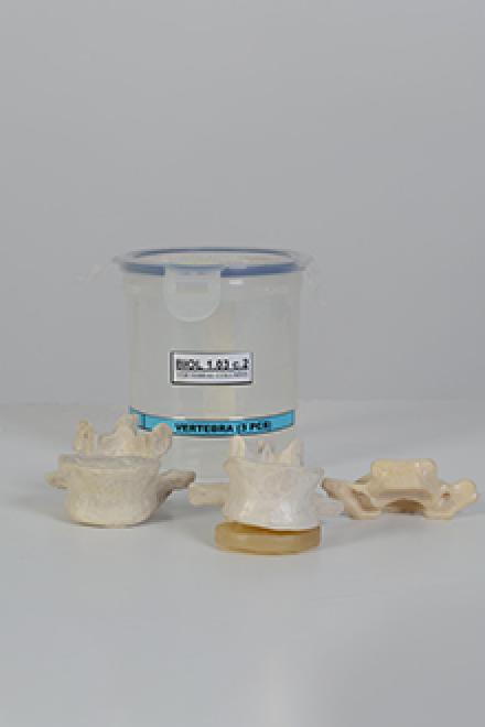 Vertebrae model #2