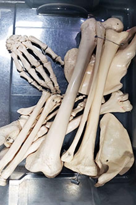 Right extremities model