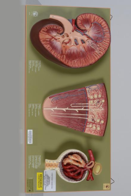 Kidney model