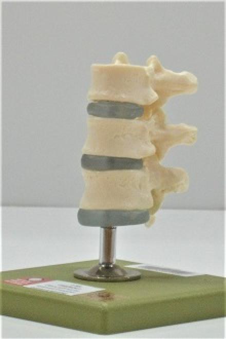 Three dorsal vertebrae with discs